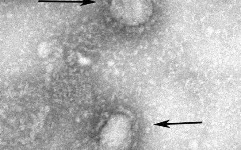 此次新型冠状病毒肺炎的“元凶”是如何被鉴定出来的？