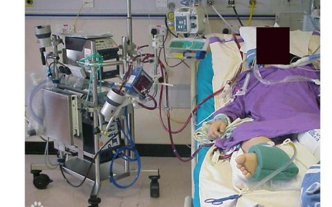 抢救新冠肺炎重症病例，是打赢疫情阻击战的关键一环！