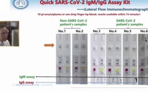 钟南山团队最新研究成果：免疫球蛋白M（IgM）检测试纸、恒温扩增芯片！