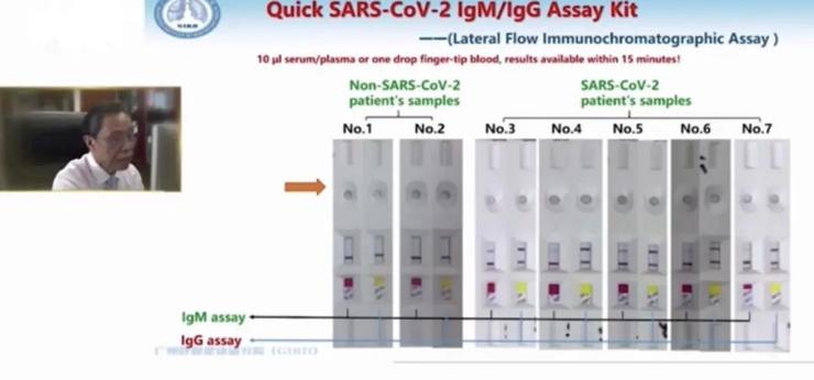 钟南山团队最新研究成果：免疫球蛋白M（IgM）检测试纸、恒温扩增芯片！
