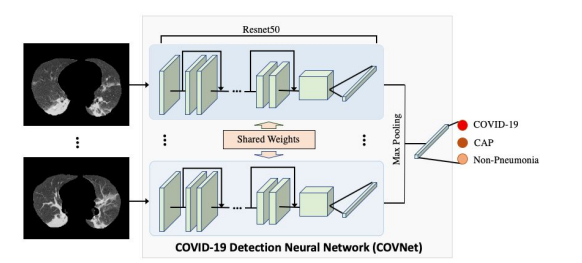 科亚医疗区分新冠肺炎与一般肺炎的“CT+AI”检测研究成果被收录！