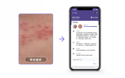 AI辅助诊断：皮肤影像诊断由最初的望诊发展到数字影像学技术！
