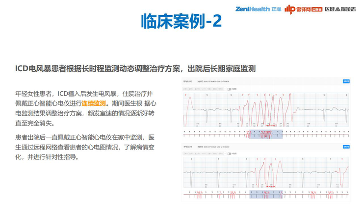 3.3亿患者、千亿级市场，巨头为何做不好一款心电检测仪？