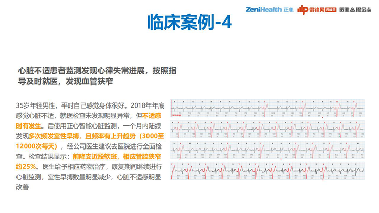 3.3亿患者、千亿级市场，巨头为何做不好一款心电检测仪？