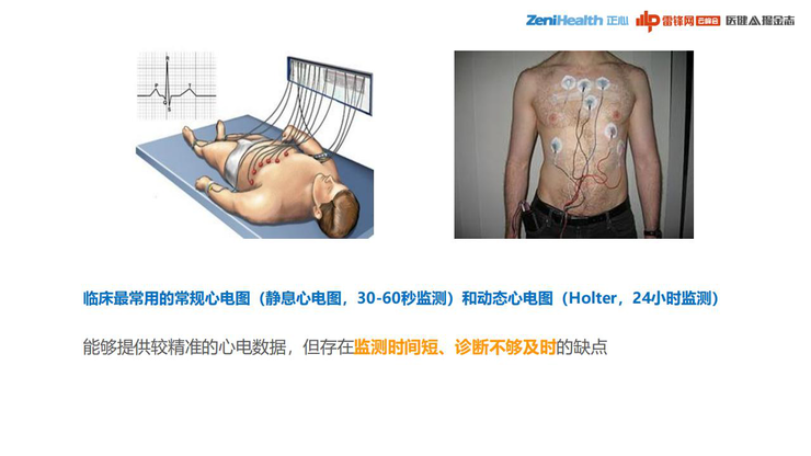 3.3亿患者、千亿级市场，巨头为何做不好一款心电检测仪？