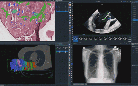 深圳大学MUSIC实验室专注医学影象AI研究，智能辅助标注、病例隐私脱敏和影像加密！