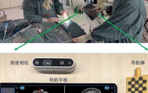 给手术配上GPS   北京协和医院与腾讯联合发布国产手术导航系统