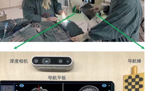 协和与腾讯联合发布国产手术导航系统：可一键生成定制化3D“透明脑”，成本降低90%