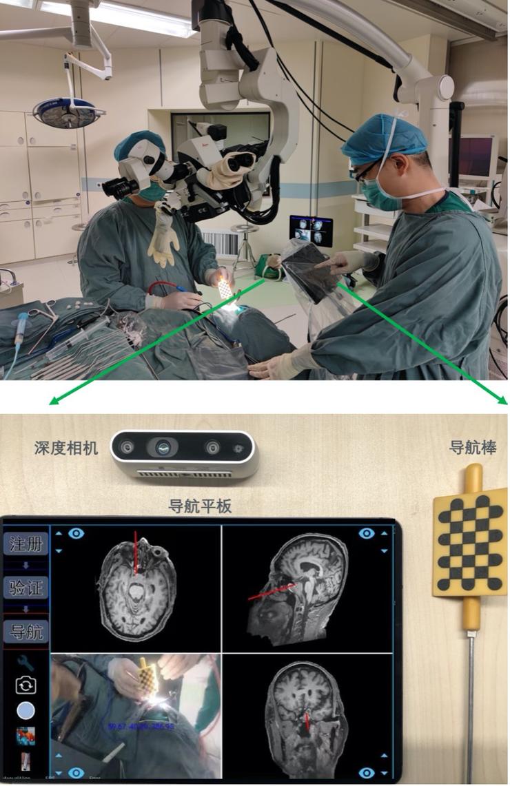 协和与腾讯联合发布国产手术导航系统：可一键生成定制化3D“透明脑”，成本降低90%