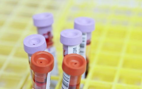 大股东最小年仅17岁，近8成收入靠代理，这家IVD公司凭什么在创业板IPO？