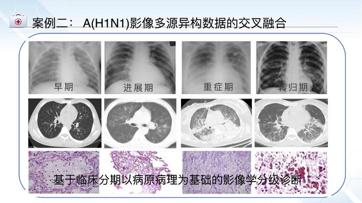 北京佑安医院放射科主任李宏军：我为什么力挺AI与影像基因组学的结合前景？｜CMAI 2022