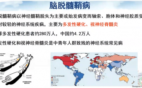 首都医科大学宣武医院副院长卢洁教授：AI在脑脱髓鞘病MRI中，有哪些应用？｜CMAI 2022
