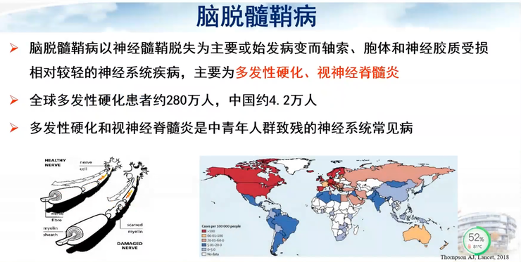 首都医科大学宣武医院副院长卢洁教授：AI在脑脱髓鞘病MRI中，有哪些应用？｜CMAI 2022