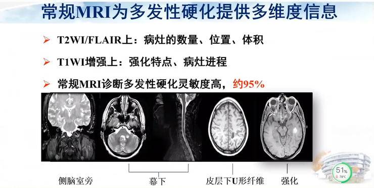 首都医科大学宣武医院副院长卢洁教授：AI在脑脱髓鞘病MRI中，有哪些应用？｜CMAI 2022