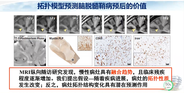 首都医科大学宣武医院副院长卢洁教授：AI在脑脱髓鞘病MRI中，有哪些应用？｜CMAI 2022