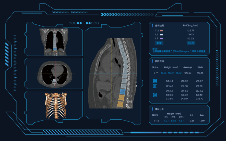 汇医慧影AI骨密度检测软件获批NMPA证：把筛查交给AI，搭建全民健康的技术“引擎”