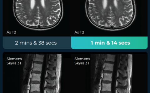 深透医疗完成数千万美金B轮融资：加速中国及全球商业化，年内订单近亿元