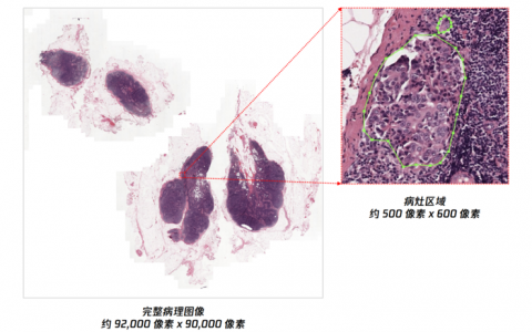 腾讯AI Lab“绝悟”首次将强化学习引入病理全片扫描，阅片效率提升400%