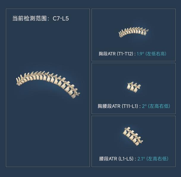 芙索特完成数千万Pre-A轮融资，助力全球儿童青少年脊柱健康筛查与诊疗