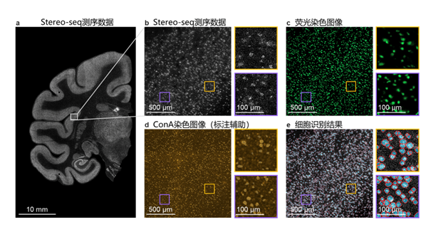 腾讯AI技术助力中国脑科学研究新突破，成果登上国际学术顶刊Cell 